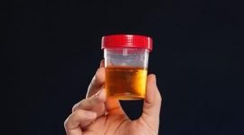 Ilustrasi tes urine.