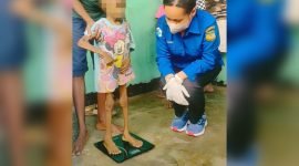 Foto seorang balita kekurangan gizi yang beredar di WAG publik. 