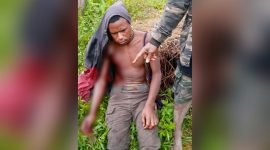 Tampak seorang korban warga sipil yang terkena tembakan di bagian pangkal lengan tangan kanannya saat kejadian kontak tembak antara TPNPB-OPM dan aparat TNI di Kampung Pamebut, Distrik Yugumuak, Kabupaten Puncak, Papua Tengah pada Jumat (3/3/2023).