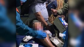 Korban penembakan, Antonius Padang, dilarikan ke RSUD Ilaga, Puncak, Papua, untuk mendapatkan perawatan medis. (Foto: Istimewa/Humas Polda Papua)