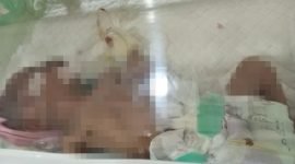 Kondisi bayi saat masih dirawat di RSUD Mimika. (Foto: Istimewa/Humas RSUD Mimika)