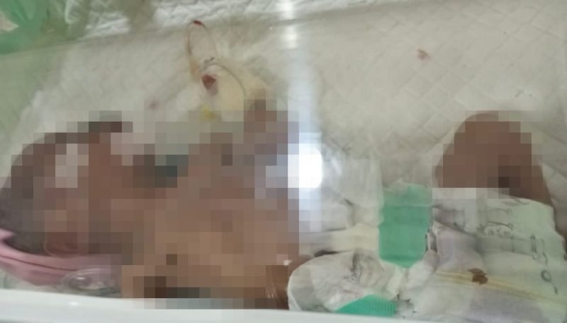 Kondisi bayi saat masih dirawat di RSUD Mimika. (Foto: Istimewa/Humas RSUD Mimika)