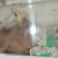 Kondisi bayi saat masih dirawat di RSUD Mimika. (Foto: Istimewa/Humas RSUD Mimika)