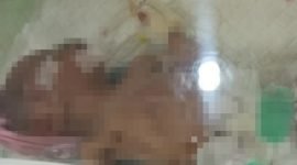 Kondisi bayi saat dirawat di RSUD Mimika. (Foto: Istimewa/Humas RSUD Mimika)