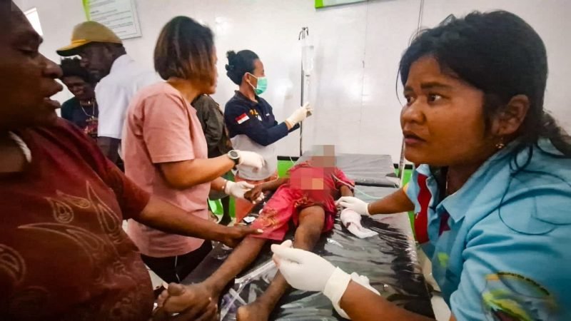 Seorang anak korban kontak tembak antara KKB dan aparat keamanan di Intan Jaya, Papua Tengah, Senin (8/4/2024). (Foto: Istimewa/Satgas Humas Damai Cartenz 2024)