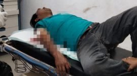 Abd Rahim, korban penusukan oleh OTK di Kabupaten Paniai, Papua Tengah. (Foto: Istimewa)