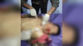 Tampak jenazah korban anggota Polres Lanny Jaya, Brigpol Johan Herik Sibarani (32 tahun). (Foto: Istimewa/Humas Polda Papua)