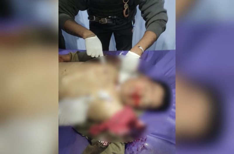 Tampak jenazah korban anggota Polres Lanny Jaya, Brigpol Johan Herik Sibarani (32 tahun). (Foto: Istimewa/Humas Polda Papua)