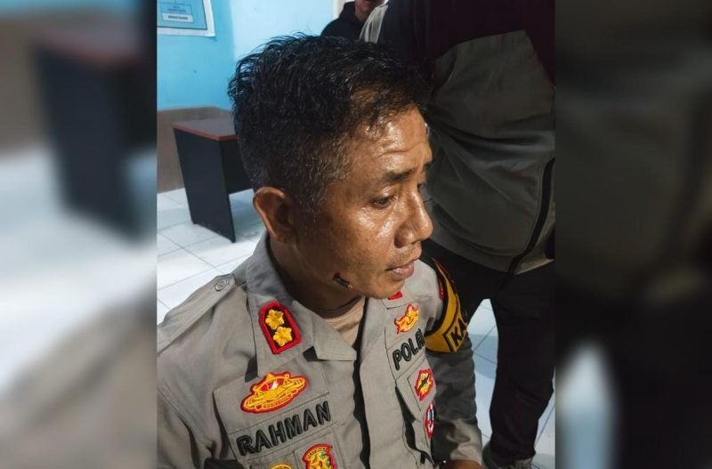 Wajah Kapolres Mamberamo Tengah, AKBP Rahman, terkena panah dari massa yang melakukan tindakan anarkis. (Foto: Istimewa/Humas Polda Papua)