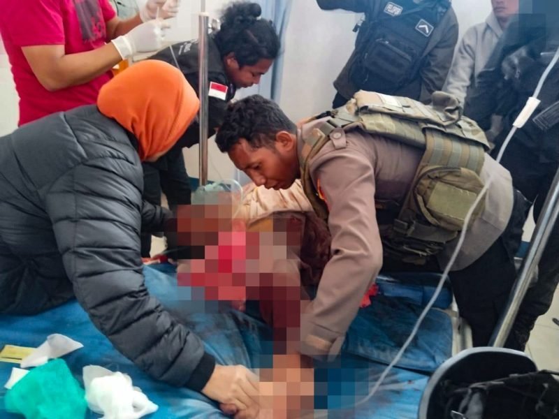 Tampak salah satu anggota Polres Lanny Jaya, korban pembacokan OTK, dirawat di RSUD Wamena. (Foto: Istimewa/Humas Polda Papua)