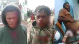 Tampak tiga korban warga masyarakat dari pertikaian yang terjadi di Dogiyai, Papua Tengah. (Foto: Istimewa/Naftal Tipagau)