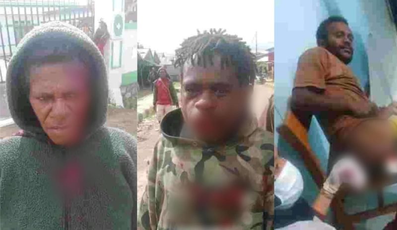 Tampak tiga korban warga masyarakat dari pertikaian yang terjadi di Dogiyai, Papua Tengah. (Foto: Istimewa/Naftal Tipagau)