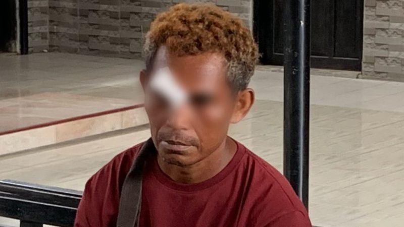 Korban penganiayaan, CVH, saat mendatangi kantor Polsek Mimika Baru untuk membuat laporan penganiayaan yang dialaminya, Kamis (13/2/2025). (Foto: Galeri Papua/Ahmad)