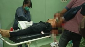 Bripka MD, korban penembakan oleh OTK, dirawat di RSUD Wamena. (Foto: Istimewa)