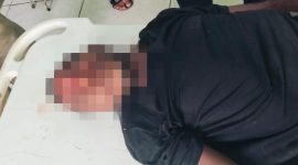 Korban meninggal dunia dibawa ke Rumah Sakit Nabire, Kamis (26/6/2025). (Foto: Istimewa)