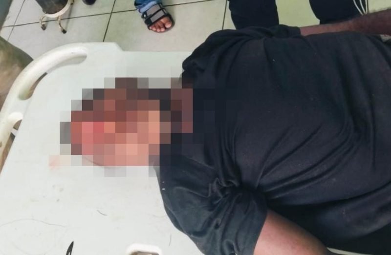 Korban meninggal dunia dibawa ke Rumah Sakit Nabire, Kamis (26/6/2025). (Foto: Istimewa)