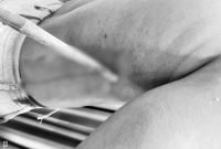 Anak panah menancap di bagian rusuk kanan tubuh korban. (Foto: Istimewa)