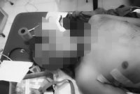 Salah satu korban pembacokan di RSUD Dekai, Yahukimo, Papua Pegunungan. (Foto: Istimewa/Dok. Satgas Humas Operasi Damai Cartenz)