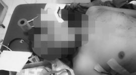 Salah satu korban pembacokan di RSUD Dekai, Yahukimo, Papua Pegunungan. (Foto: Istimewa/Dok. Satgas Humas Operasi Damai Cartenz)