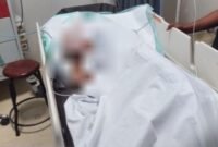 D.P dievakuasi dan dirawat di RSUD Mimika. (Foto: Humas Polres Mimika)