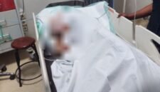 D.P dievakuasi dan dirawat di RSUD Mimika. (Foto: Humas Polres Mimika)