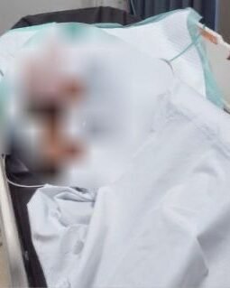 berita-rekomendasi-foto