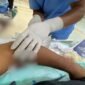 Korban mendapat penanganan medis di RSUD Mimika. (Foto: Istimewa)